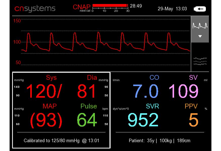 Monitoramento Hemodinâmico